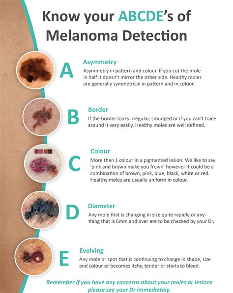 frequency of skin checks after melanoma
